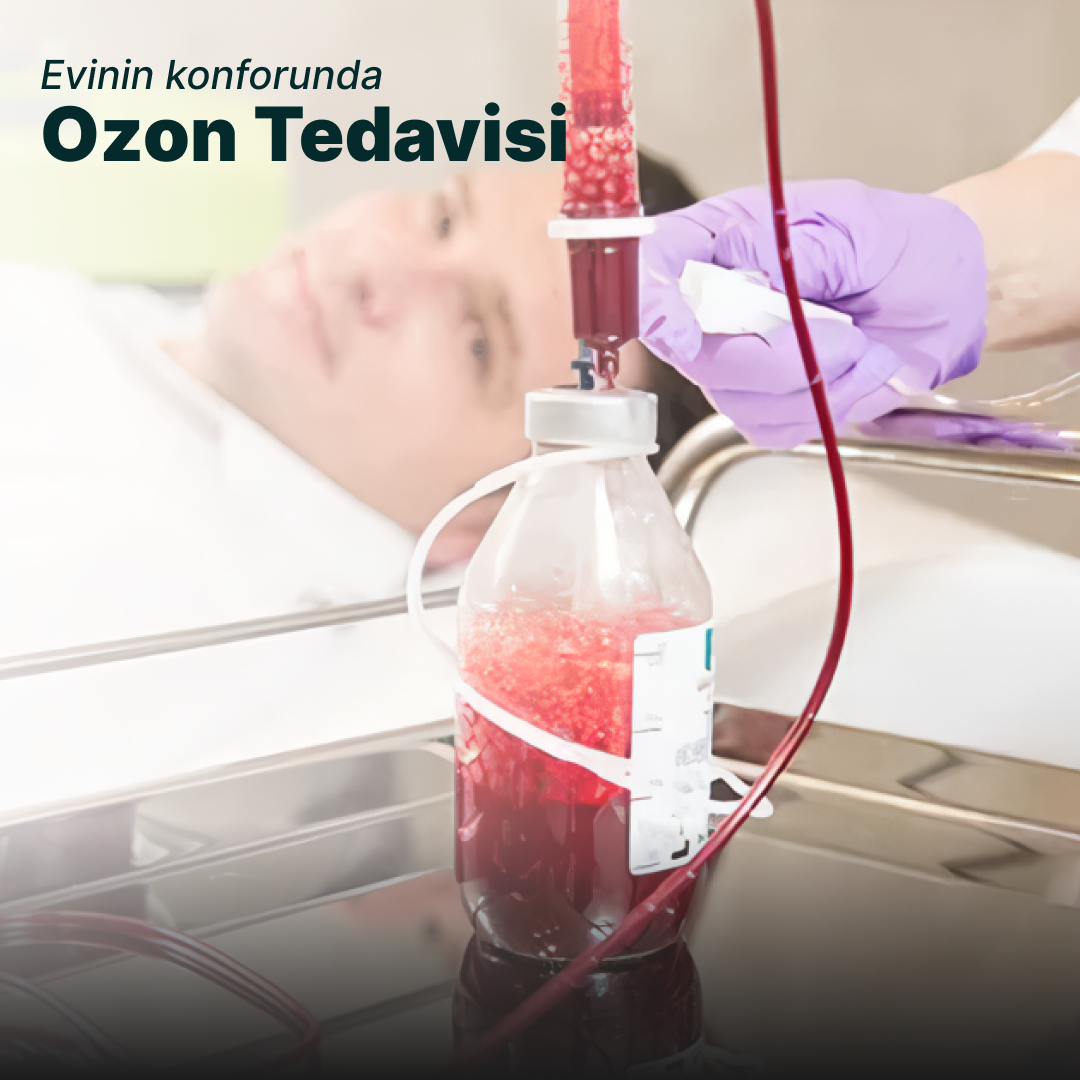 Evde Ozon Tedavisi