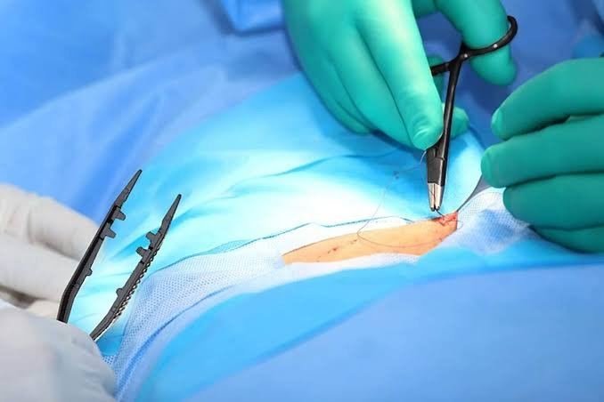 Ameliyat Sonrası Enfeksiyon Belirtileri Nelerdir? Ne Zaman Doktor Çağrılmalıdır?